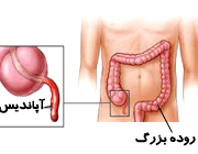 آپاندیس