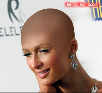 سوپر استار های معروف را کچل ببینید (عکسهای جالب) Paris Hilton balderized سوپر استار های معروف را کچل ببینید (عکسهای جالب)