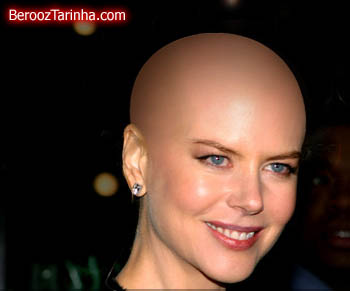 سوپر استار های معروف را کچل ببینید (عکسهای جالب) Nicole Kidman balderized سوپر استار های معروف را کچل ببینید (عکسهای جالب)
