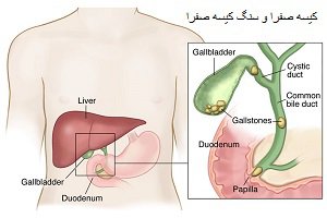 برگشت صفرا