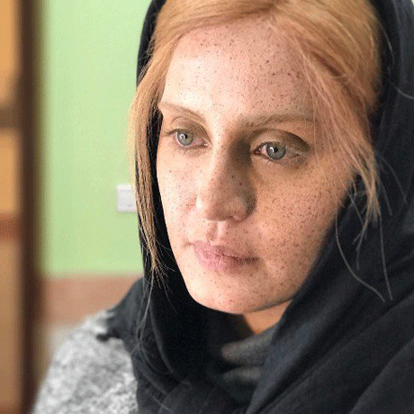 چهره کک و مکی و ناراحت کننده الناز شاکردوست! +عکس چهره کک و مکی و ناراحت کننده الناز شاکردوست! +عکس