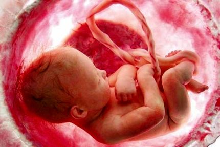 وزارت بهداشت: غربالگری ممنوع نیست و استانداردسازی شده است